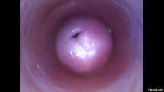 Endoscope camera shows pussy inside